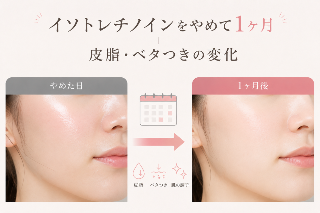 イソトレチノインをやめて1ヶ月|皮脂・ベタつきの変化(イソトレチノインをやめて1ヶ月後の変化)