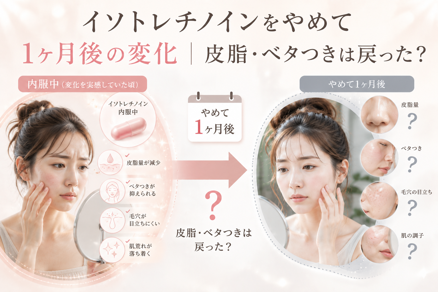イソトレチノインをやめて1ヶ月後の変化｜皮脂・ベタつきは戻った？