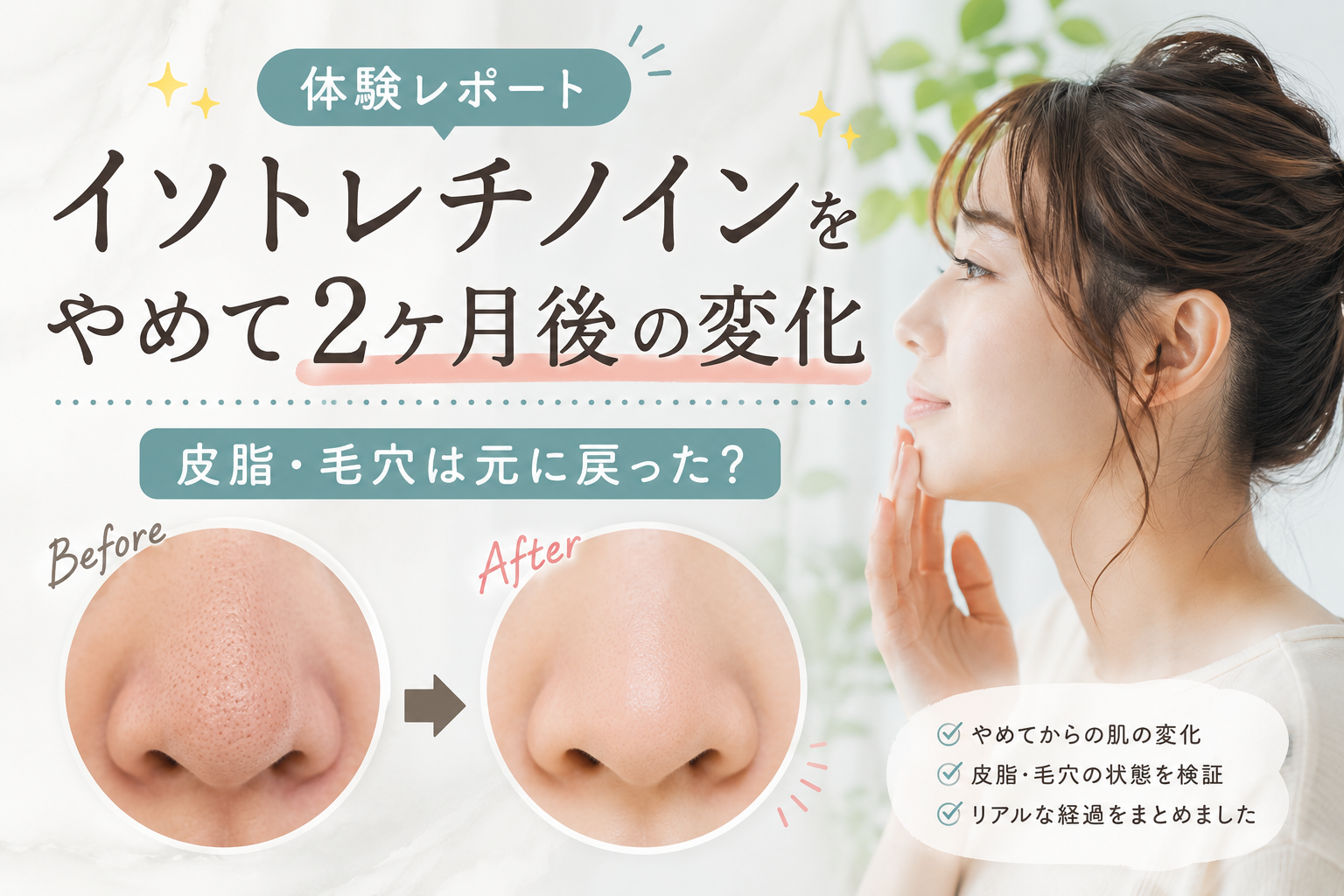 イソトレチノインをやめて2ヶ月後の変化｜皮脂・毛穴は元に戻った？